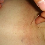la-prevenzione-delle-tre-malattie-piu-diffuse