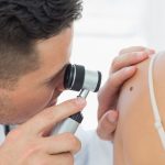 melanoma